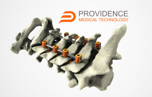 Providence Medical Technology